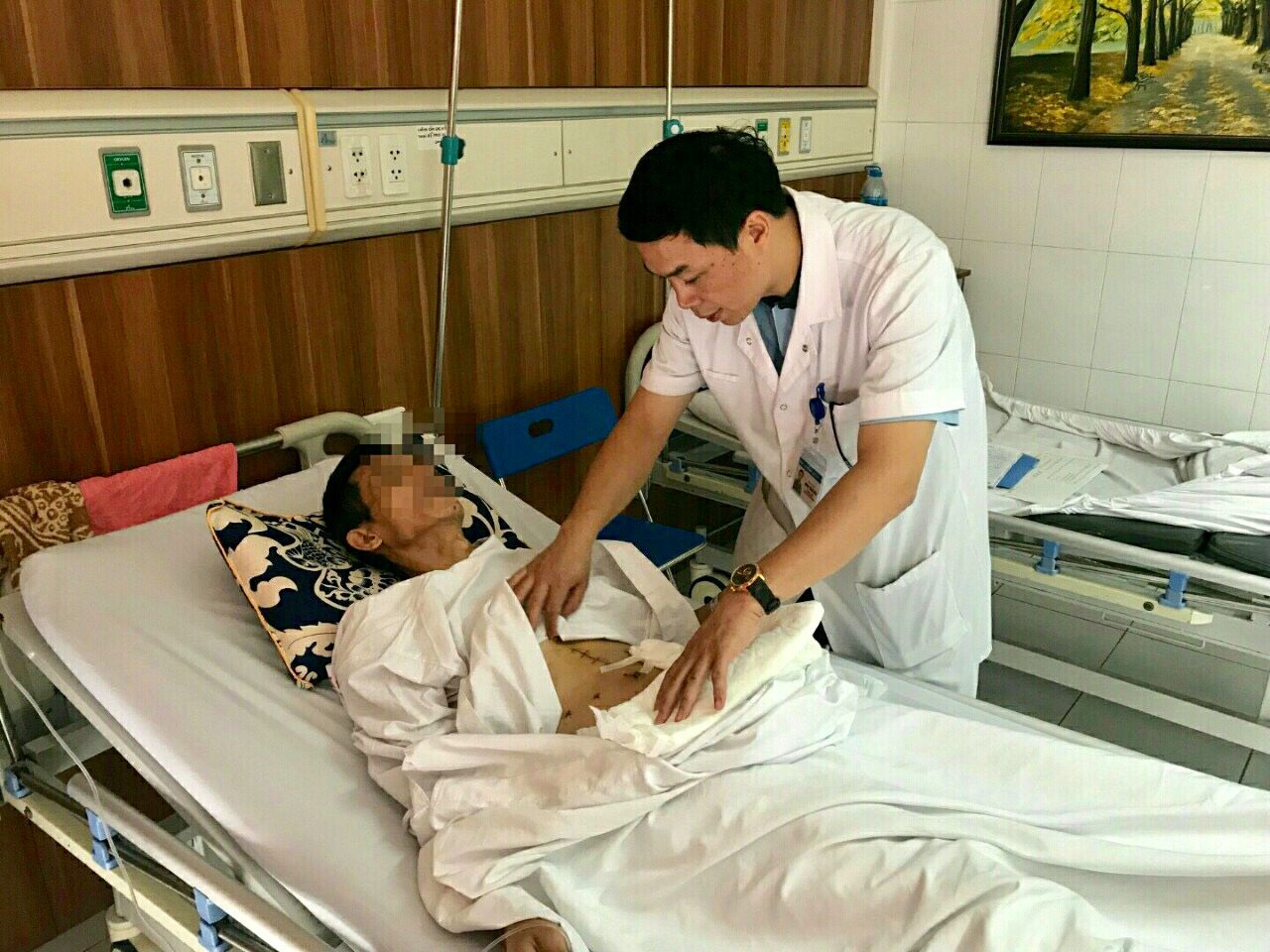 Phẫu thuật u buồng trứng, bác sĩ phát hiện bệnh nhân nữ 22 tuổi bị ung thư dạ dày - Bệnh viện Việt Đức