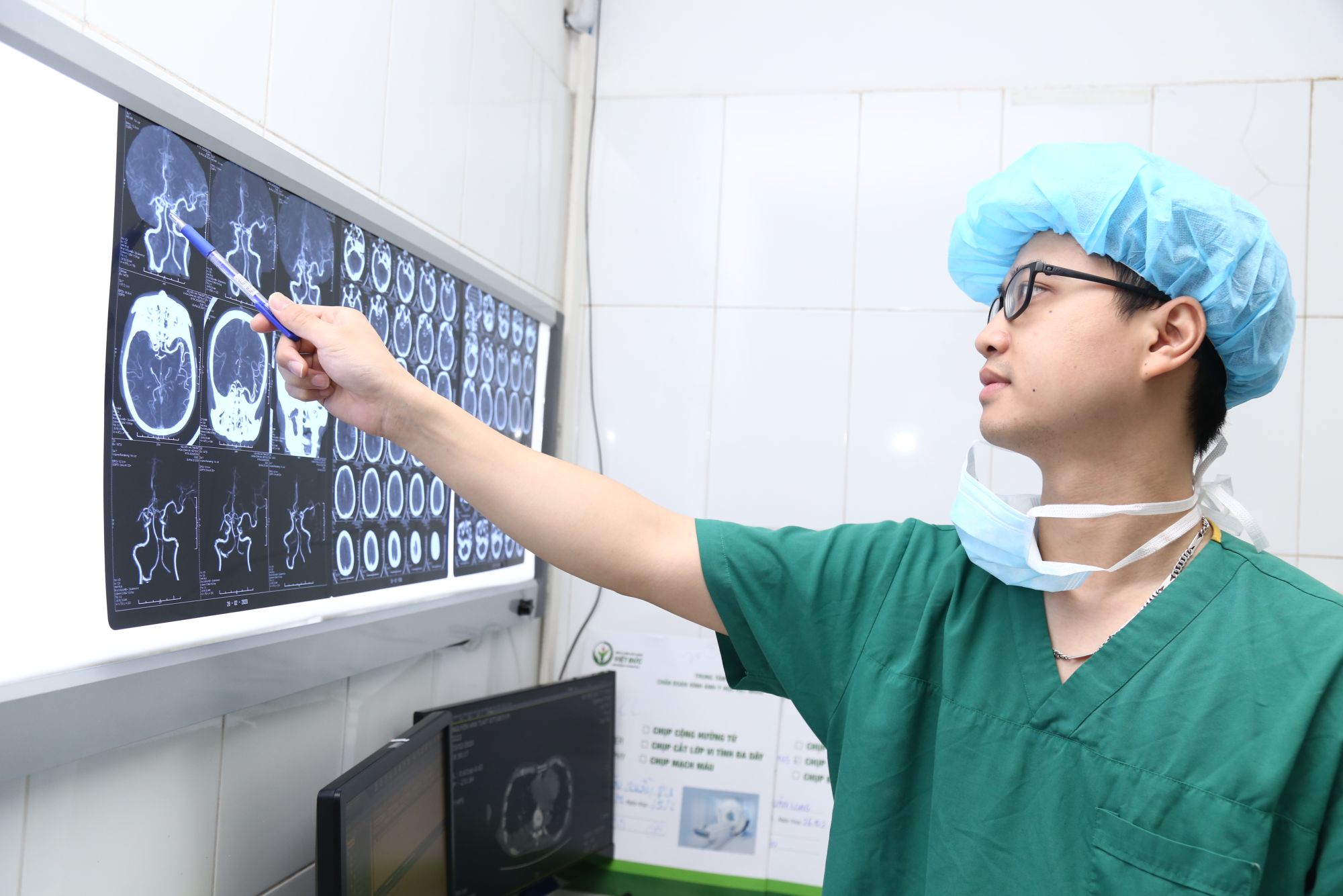 Đột quỵ não: “Thời gian vàng” trong chẩn đoán và điều trị - Bệnh viện Việt Đức