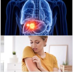 TÍN HIỆU “VẶT VÃNH” CẢNH BÁO UNG THƯ GAN CÓ THỂ ĐANG TRÚ TRONG CƠ THỂ BẠN