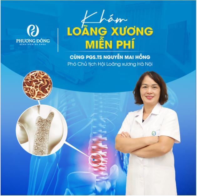 Khám loãng xương miễn phí