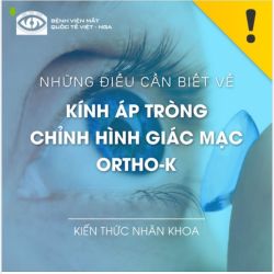 Những điều cần biết về KÍNH ÁP TRÒNG CHỈNH HÌNH GIÁC MẠC ORTHO-K