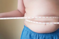 4 lầm tưởng về bệnh béo phì