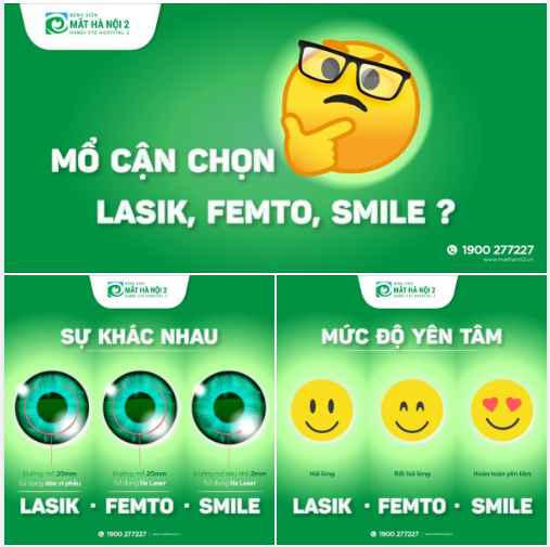 LASIK, FEMTO, SMILE? MỔ CẬN NÊN CHỌN PHƯƠNG PHÁP NÀO?