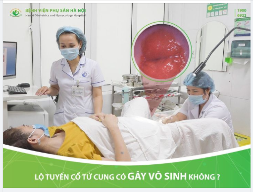 Lộ tuyến cổ tử cung phần 2 lộ tuyến cổ tử cung có gây vô sinh không? khi nào cần điều trị lộ tuyến?