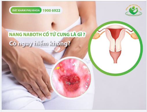 Lộ tuyến cổ tử cung phần 3 nang naboth cổ tử cung là gì, có nguy hiểm không
