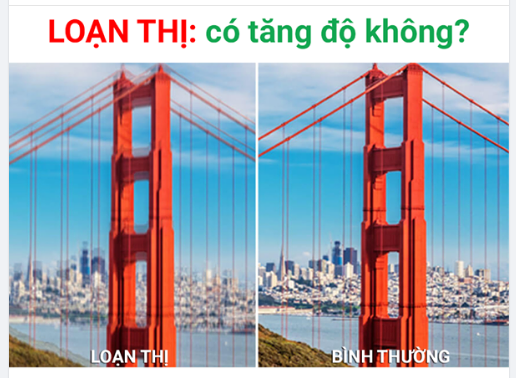 Loạn thị có tăng độ như các tật khúc xạ không?