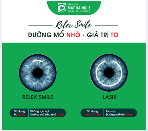 Mổ cận bằng phương pháp RELEX SMILE: Đường mổ NHỎ - giá trị TO