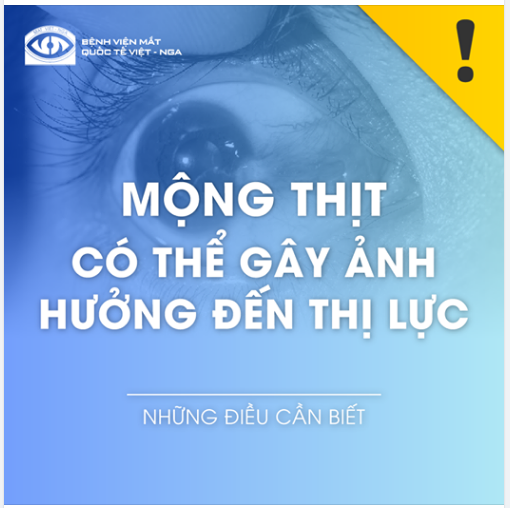 MỘNG THỊT CÓ THỂ GÂY ẢNH HƯỞNG ĐẾN THỊ LỰC