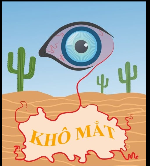 MÙA ĐÔNG, CẢNH GIÁC BỆNH KHÔ MẮT