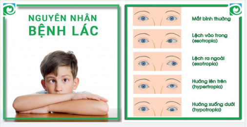 NGUYÊN NHÂN BỆNH LÁC