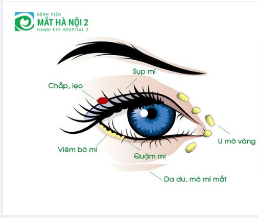 NHẬN BIẾT CÁC BỆNH LÝ TẠI MI MẮT