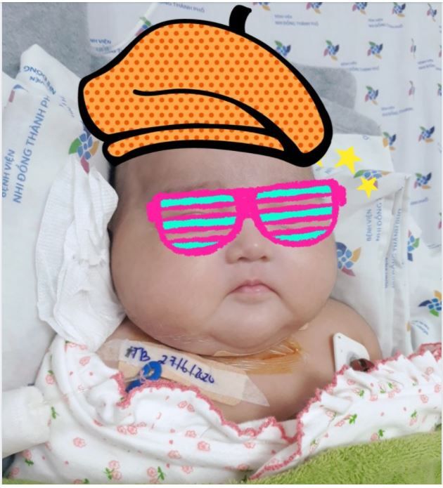 NHÂN TRƯỜNG HỢP CẤP CỨU CO GIẬT THÀNH CÔNG CHO MỘT TRẺ BỤ BẪM HẠ ĐƯỜNG HUYẾT KÉO DÀI..