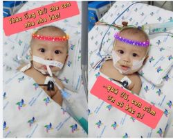 NHỌC NHẰN VÀ KHÓ LƯỜNG VỚI..VIÊM MÀNG NÃO TRẺ EM