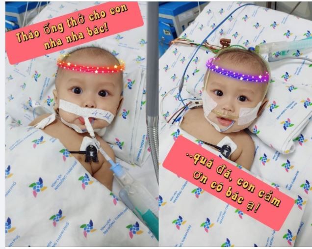 NHỌC NHẰN VÀ KHÓ LƯỜNG VỚI..VIÊM MÀNG NÃO TRẺ EM