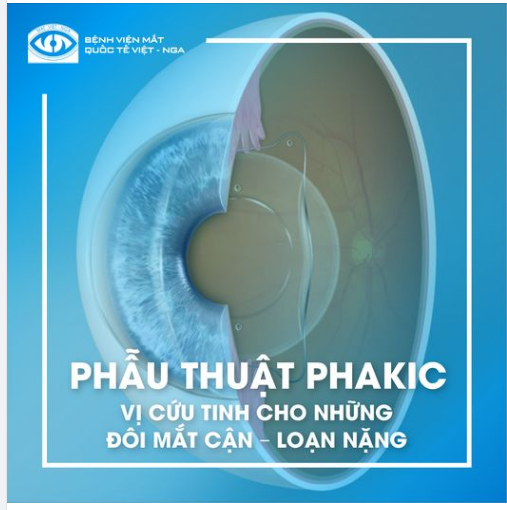 PHẪU THUẬT PHAKIC VỊ CỨU TINH CHO NHỮNG ĐÔI MẮT CẬN LOẠN NẶNG