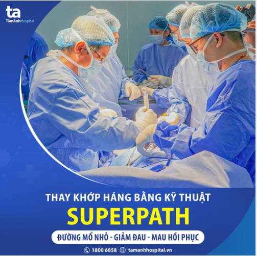 PHẪU THUẬT THAY KHỚP HÁNG BẰNG KỸ THUẬT SUPERPATH CHO BỆNH NHÂN BỊ HOẠI TỬ CHỎM XƯƠNG ĐÙI: ĐƯỜNG MỔ NHỎ, ÍT XÂM LẤN, KHÔNG CẮT CƠ, CÓ THỂ ĐI LẠI 24H SAU MỔ.