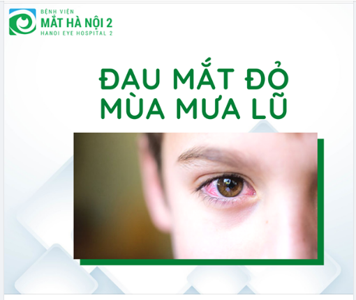 Phòng bệnh đau mắt đỏ mùa mưa lũ