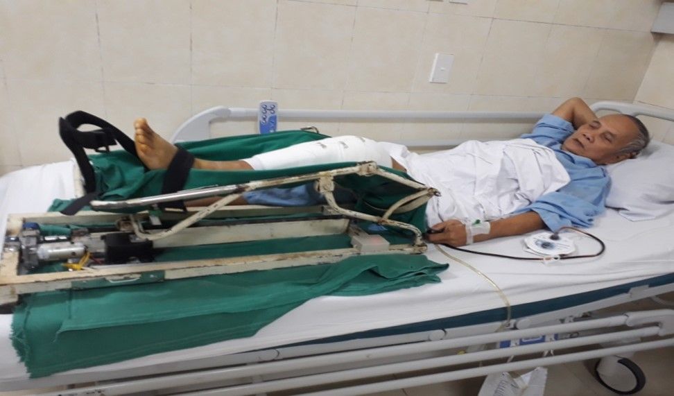 Cải tiến khung tập vận động gối AK 1C cho người bệnh sau phẫu thuật khớp gối - Bệnh viện Việt Đức