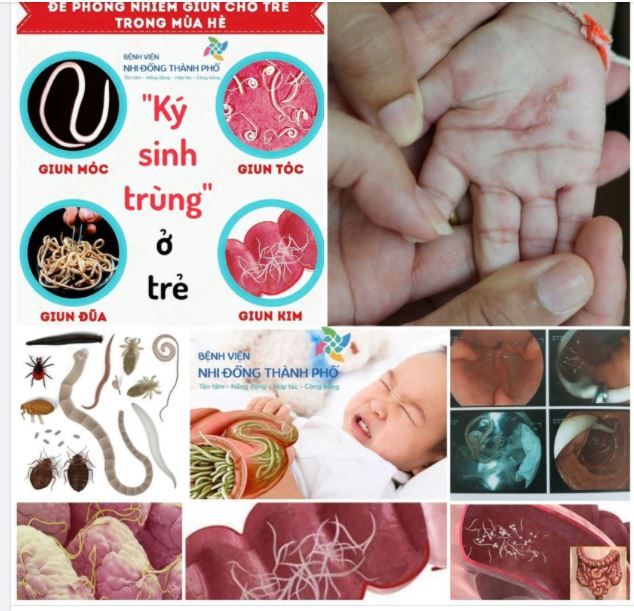 ĐỪNG ĐỂ TRẺ CÒI CỌC BIẾNG ĂN, THIẾU MÁU CHỈ VÌ QUÊN "TẨY GIUN"