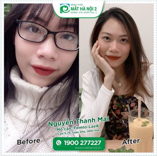 THOÁT CẢNH ĐEO THÌ MỜ KHÔNG ĐEO THÌ MỜ