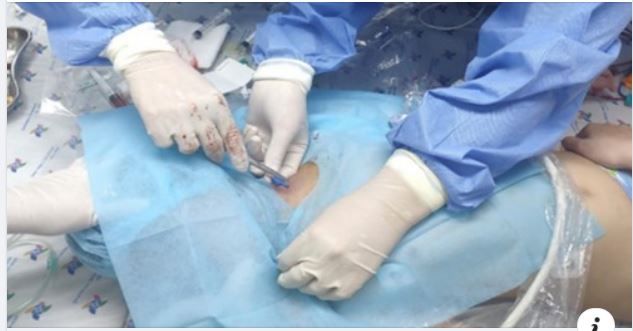 TRẺ SỐC THUỐC NẶNG, TIM ĐẬP LOẠN NHỊP SAU KHI UỐNG THUỐC VIÊM HỌNG MẸ MUA NGOÀI NHÀ THUỐC