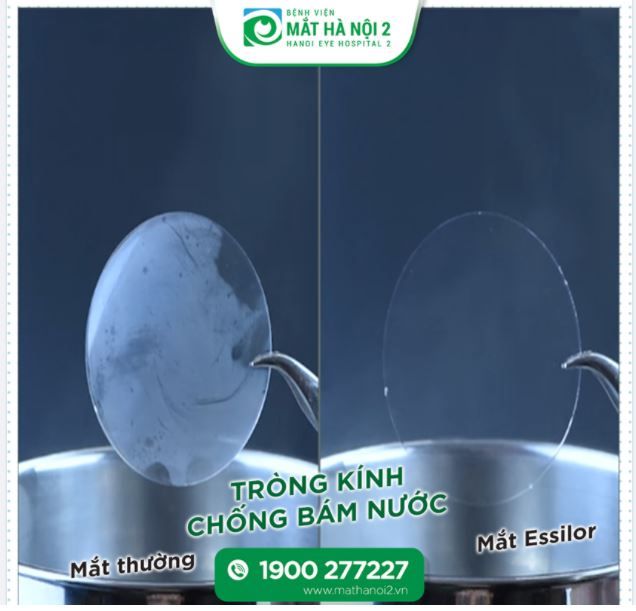 Bạn có cần: Tròng kính chống bám nước?