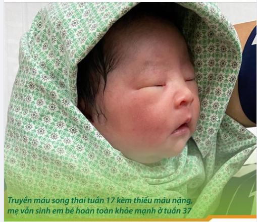 Truyền máu song thai kèm triệu chứng thiếu máu nặng, mẹ vẫn sinh bé hoàn toàn khỏe mạnh ở tuần 37