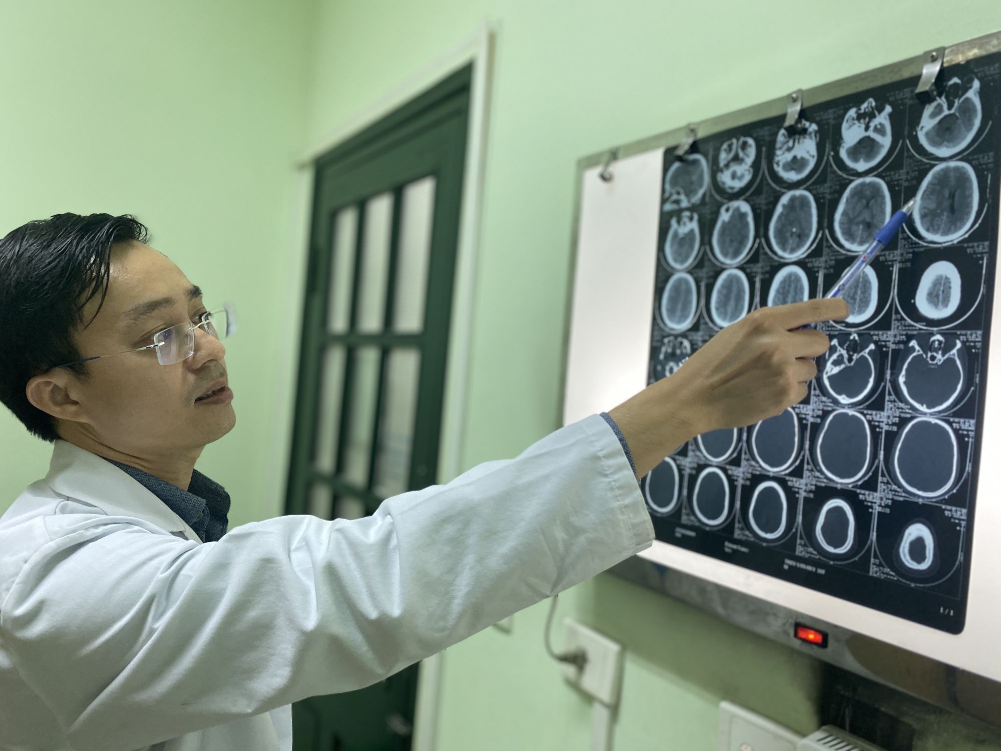 Nổ bình ga mini khi đang nấu ăn, người đàn ông bị đa chấn thương, bỏng sâu vùng mặt - Bệnh viện Việt Đức