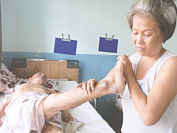 Chăm sóc loét do tì đè - Bệnh viện 108