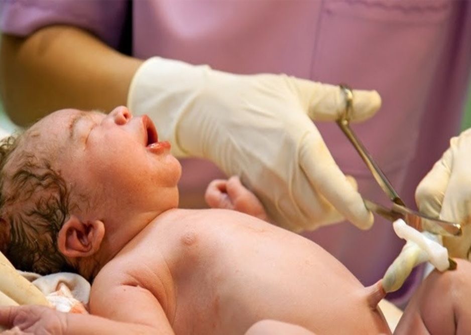 Uốn ván rốn ở trẻ em - Bệnh viện 108
