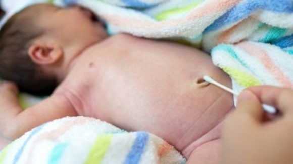 Chăm sóc da, mắt, rốn ở trẻ sơ sinh - Bệnh viện nhi Trung Ương