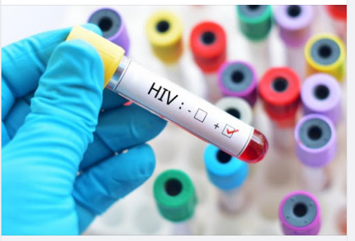 XÉT NGHIỆM NHANH HIV CÓ THỰC SỰ CHÍNH XÁC??