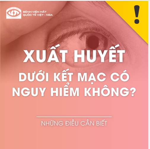XUẤT HUYẾT DƯỚI KẾT MẠC CÓ NGUY HIỂM KHÔNG ?