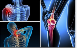 XƯƠNG KHỚP "KÊU CỨU" BỞI 12 THÓI QUEN AI CŨNG MẮC PHẢI