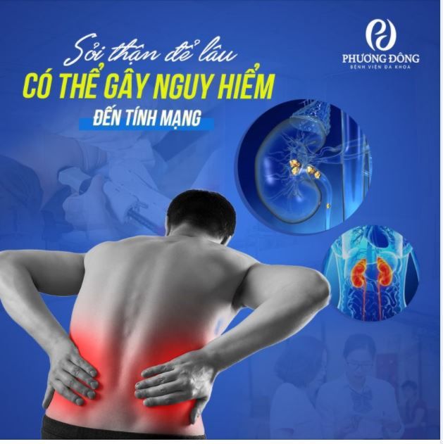 SỎI THẬN ĐỂ LÂU CÓ THỂ GÂY NGUY HIỂM ĐẾN TÍNH MẠNG