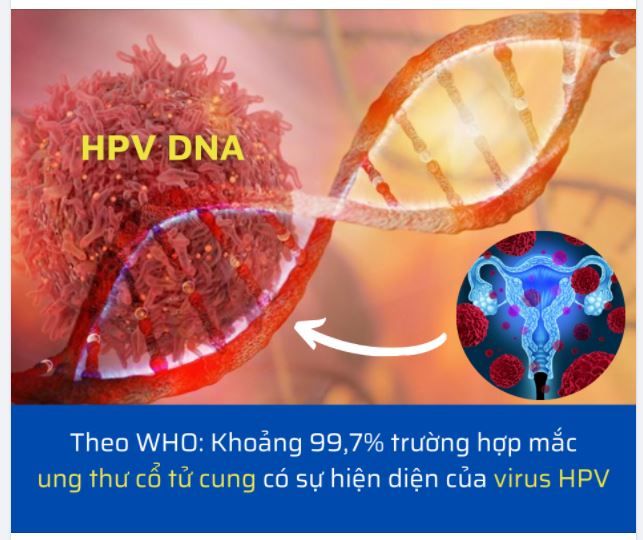 HPV DNA - XÉT NGHIỆM ĐẦU TAY TẦM SOÁT UNG THƯ CỔ TỬ CUNG