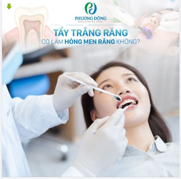 Tẩy trắng răng có làm hỏng men răng không?