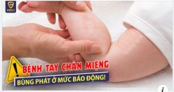 CẢNH BÁO: ĐỈNH ĐIỂM DỊCH TAY CHÂN MIỆNG Ở TRẺ NHỎ.