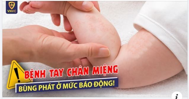 CẢNH BÁO: ĐỈNH ĐIỂM DỊCH TAY CHÂN MIỆNG Ở TRẺ NHỎ.