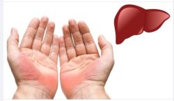 Gan của bạn có đang KHỎE MẠNH?