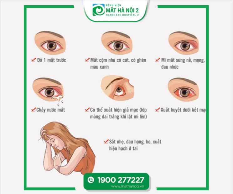 CẨN TRỌNG DỊCH ĐAU MẮT ĐỎ NGÀY GIAO MÙA