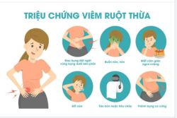 6 TRIỆU CHỨNG CỦA VIÊM RUỘT THỪA KHÔNG NÊN CHỦ QUAN