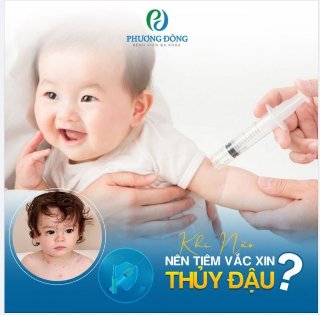 NÊN TIÊM VẮC XIN THỦY ĐẬU KHI NÀO?