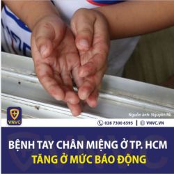 BỆNH TAY CHÂN MIỆNG TẠI TP.HCM VÀ MỘT SỐ TỈNH THÀNH ĐANG GIA TĂNG NHANH Ở MỨC BÁO ĐỘNG