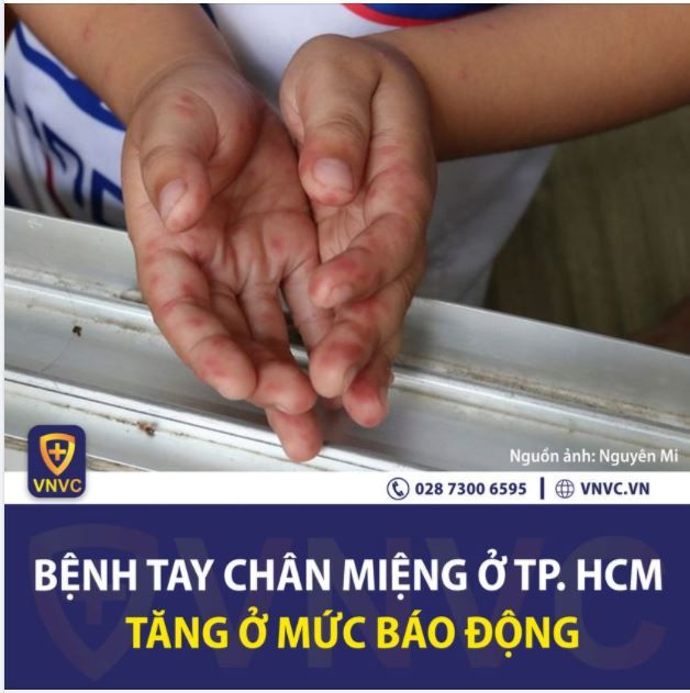 BỆNH TAY CHÂN MIỆNG TẠI TP.HCM VÀ MỘT SỐ TỈNH THÀNH ĐANG GIA TĂNG NHANH Ở MỨC BÁO ĐỘNG