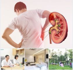 NHỮNG ĐIỀU BẠN NÊN BIẾT VỀ SỎI THẬN - TIẾT NIỆU