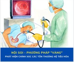 BỎ TÚI NHỮNG KIẾN THỨC CẦN BIẾT VỀ NỘI SOI DẠ DÀY