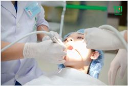 QUY TRÌNH NHỔ RĂNG KHÔN SIÊU ÂM KHÔNG ĐAU PIEZOTOME TẠI THU CÚC