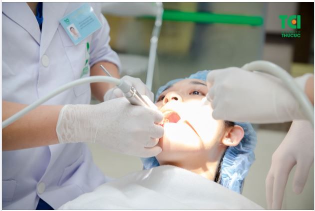 QUY TRÌNH NHỔ RĂNG KHÔN SIÊU ÂM KHÔNG ĐAU PIEZOTOME TẠI THU CÚC