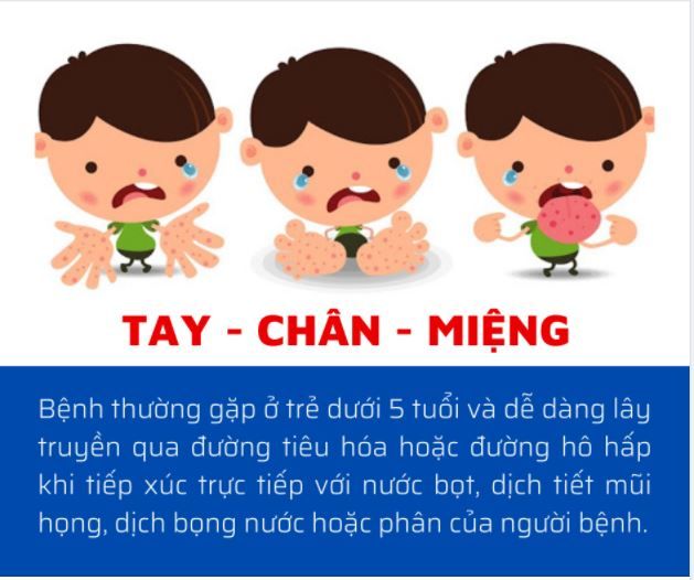 TRẺ MẮC TAY CHÂN MIỆNG TĂNG CAO - ĐÃ CÓ TRƯỜNG HỢP TỬ VONG